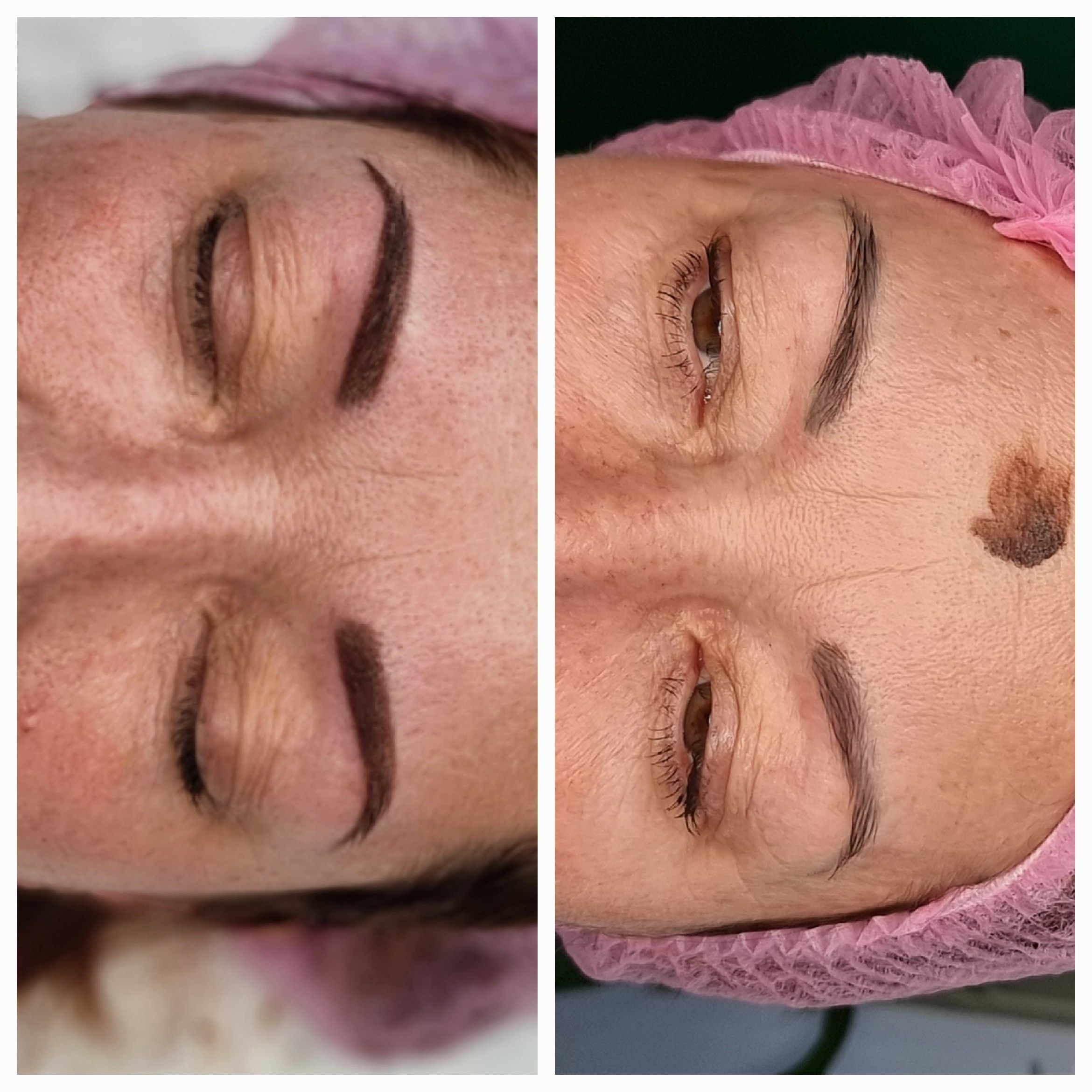 Eyebrow shaping result